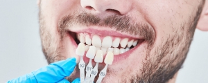 Cost of Porcelain Veneers: What You Need to Know Cost of Porcelain Veneers: What You Need to Know